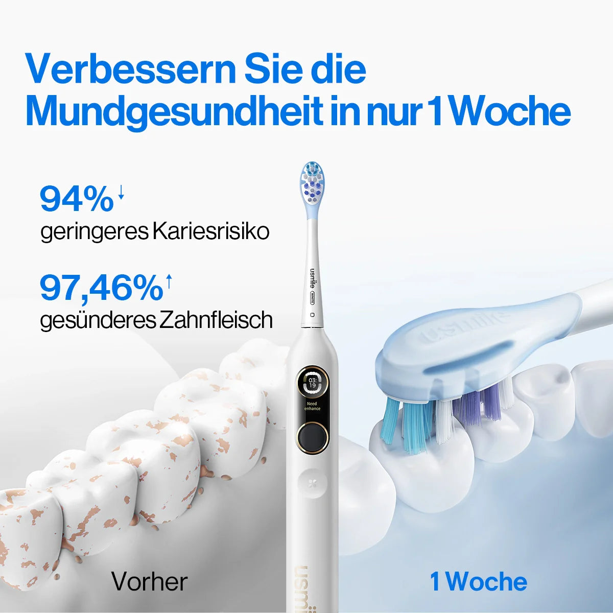 usmile Y10 PRO Elektrische Zahnbürste mit Erinnerung an ausgelassene Stellen